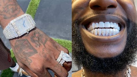 gucci white teeth|Gucci Mane Drops $250K Bands On New Diamond Teeth.